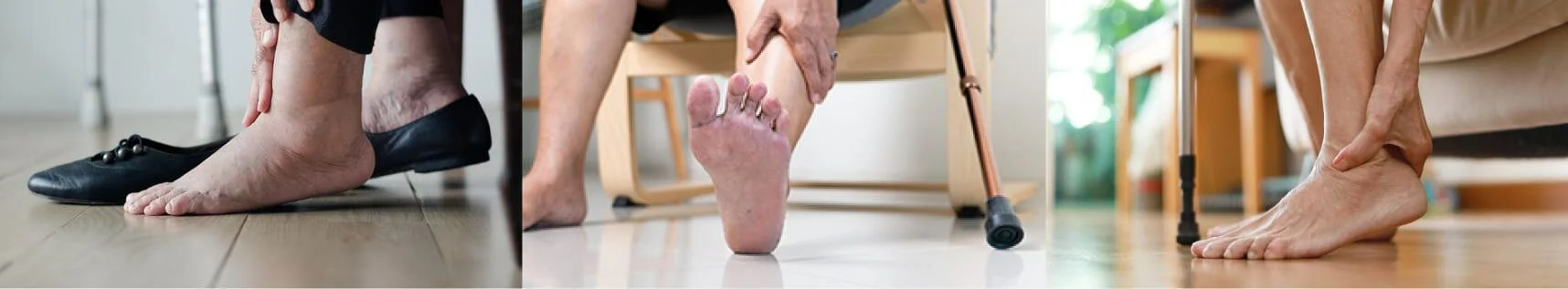 Foot Fatigue